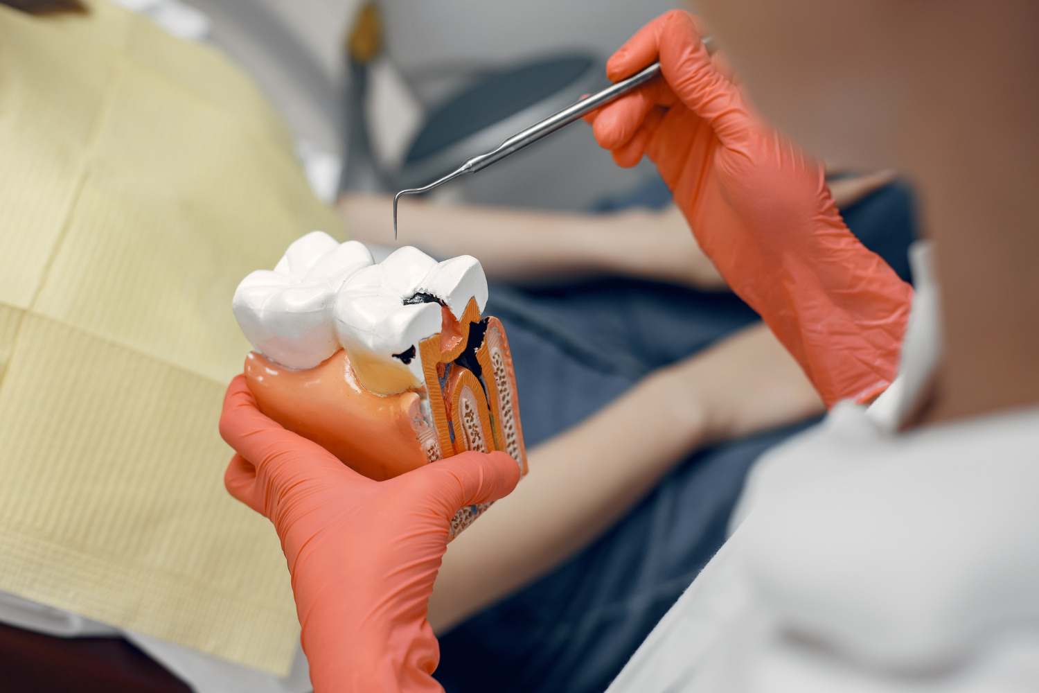 Endodoncia y corona: ¿por qué?