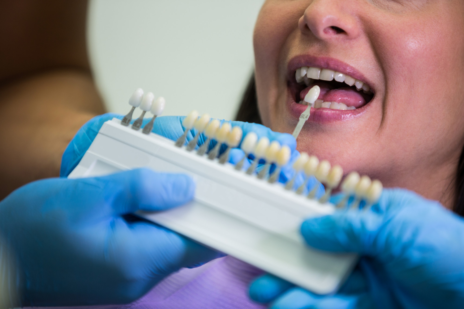 Fumo, ¿me pongo implantes?